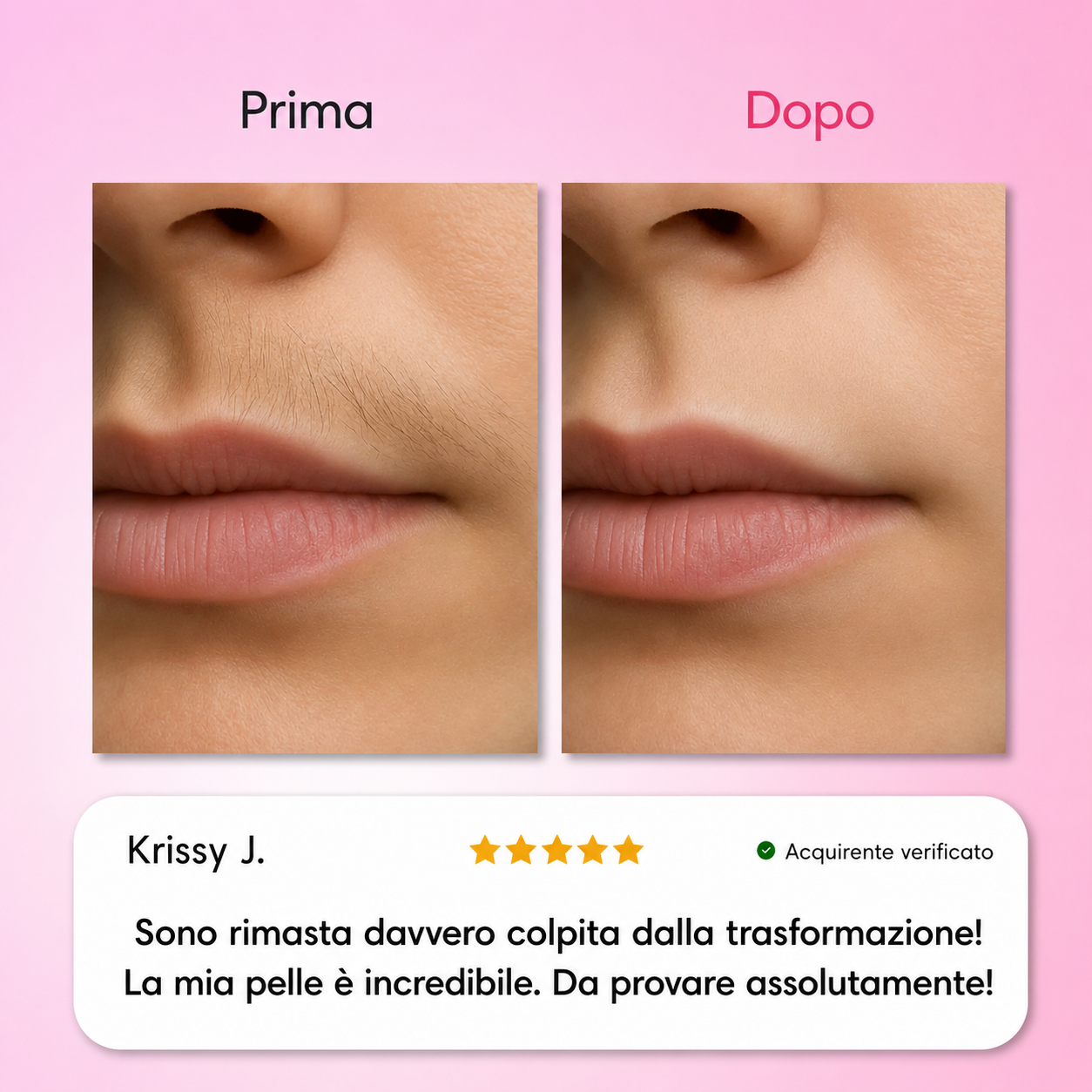 Dermelia - Kit Trilogy per la depilazione